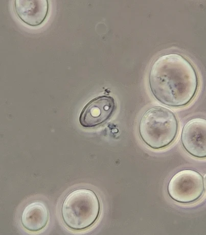 Phase contrast micrograph of one small thin-walled ovoid cell with visible inclusions among several larger round yeast cells