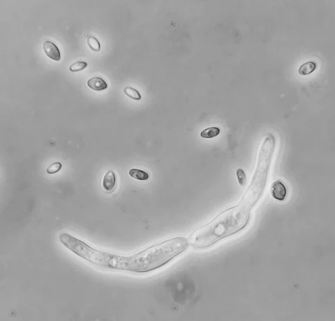 Phase contrast micrograph of lemon-shaped yeast cells with one long branching pseudohyphal filament running across the lower half of the field