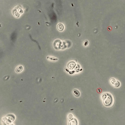 Yeast cells with small rod-shaped bacteria scattered among them, two rods circled in red, phase contrast