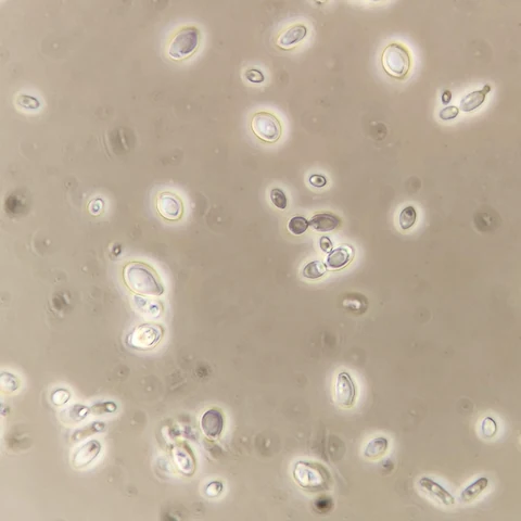 Ovoid to oval yeast cells of varying size, several budding pairs and small groups, clear background, 1000x phase contrast