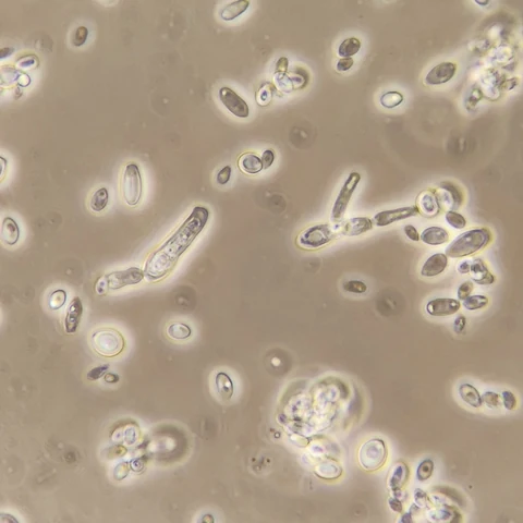 Ovoid and elongate yeast cells, some joined end to end in short branching chains, and small clumps, 1000x phase contrast