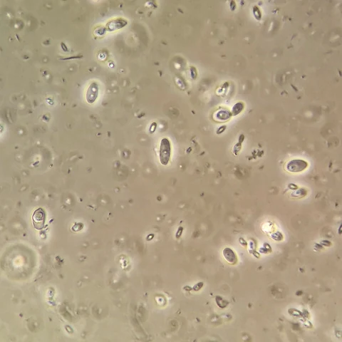 Scattered ovoid yeast cells among many small dark particles in the background, 1000x phase contrast