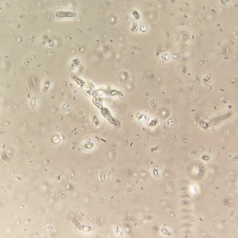 A short branching chain of elongate yeast cells and scattered single cells among small dark particles, 1000x phase contrast