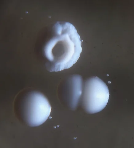 Close-up of three colony types: a large irregular crater-shaped colony above, two large smooth domed colonies below, and tiny pin-point colonies around them
