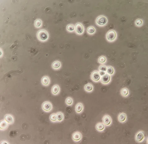 Round to oval yeast cells, singly and in small clusters, some with visible granules, 1000x oil immersion, phase contrast