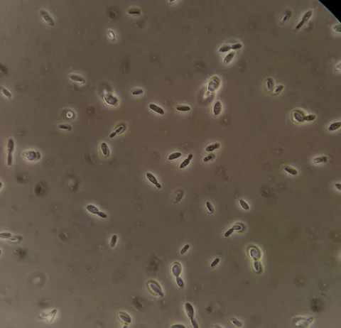Small elongated and ogival yeast cells, many budding in pairs or short chains, 1000x oil immersion, phase contrast