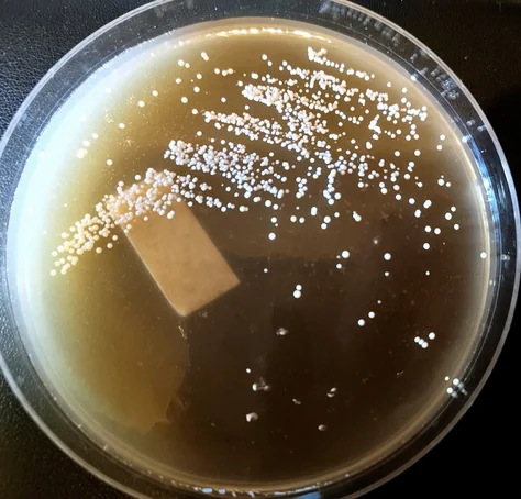 Confirmation plate streaked with many small uniform white colonies, a paper label on the agar