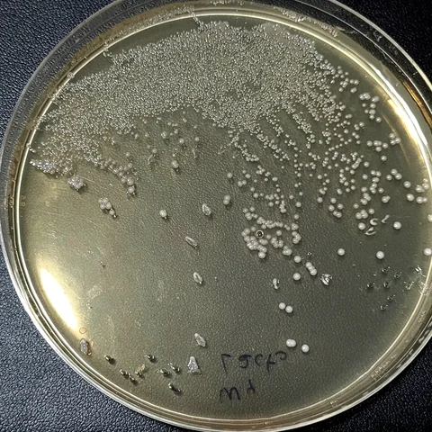 Plate with a dense spread of small cream colonies across the upper half, larger round white colonies scattered below, and a few flat, irregular, translucent colonies near the lower edge, handwritten label on the base